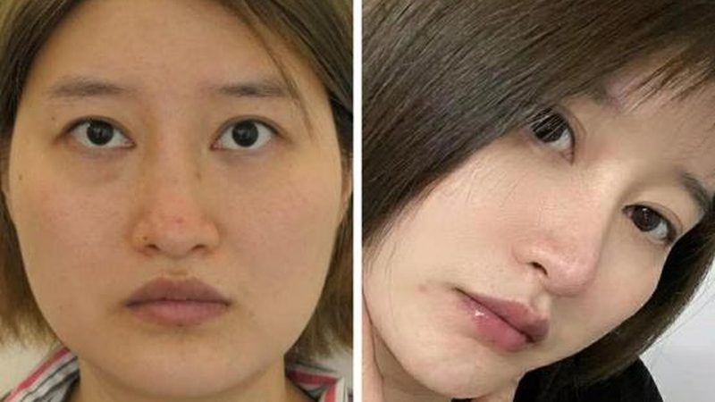 皮肤管理中心房租成本如何有效降低？**