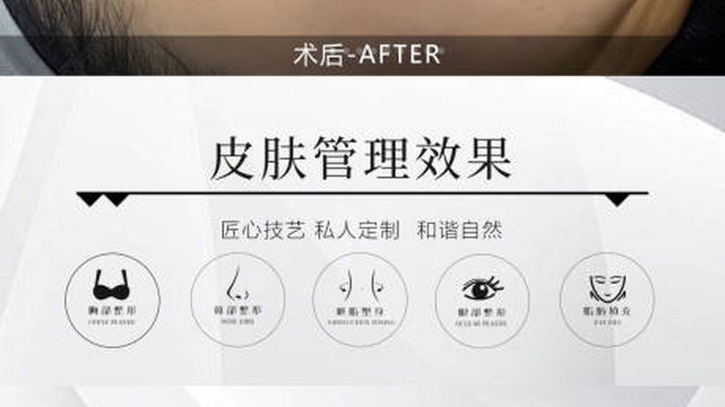 抗衰激光超声刀，如何辨别正规机构？**
