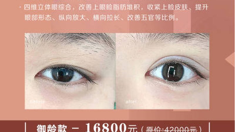 玻尿酸代理加盟，揭秘完整流程与关键步骤