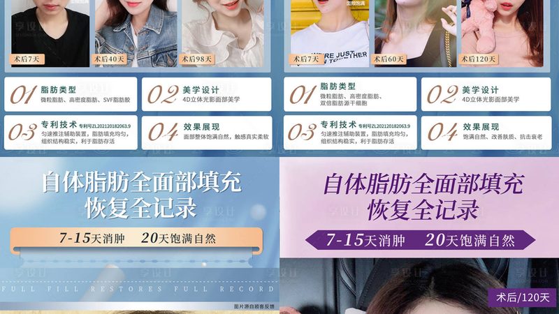 水光针注射，揭秘上海地区价格背后的秘密**
