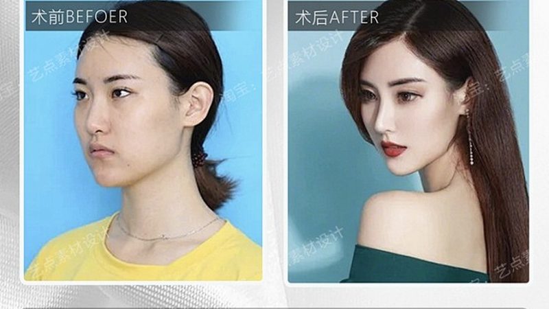 上海腋下激光脱毛价格揭秘：影响因素大解析