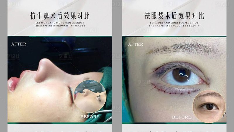 小标题：成分揭秘：透明质酸、肉毒素与A型肉毒毒素