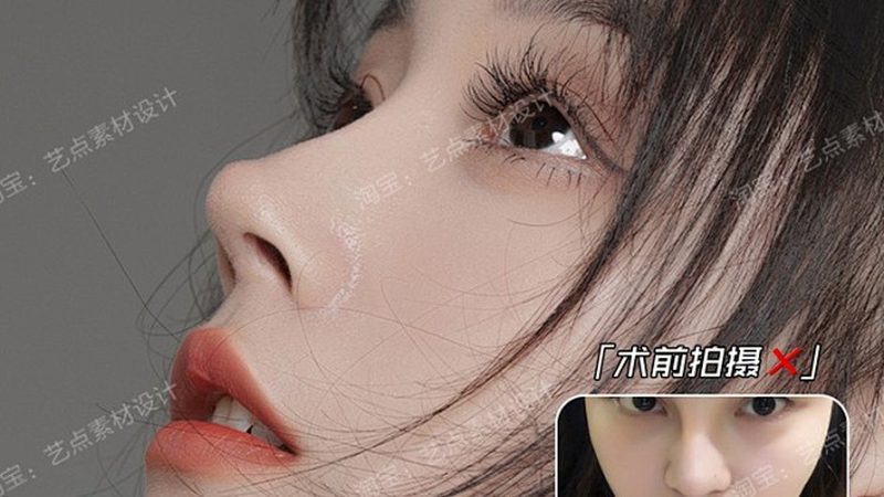 激光祛斑后擦什么药膏