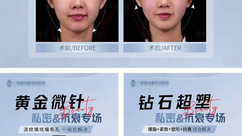 行业背景：国产医美品牌的发展态势