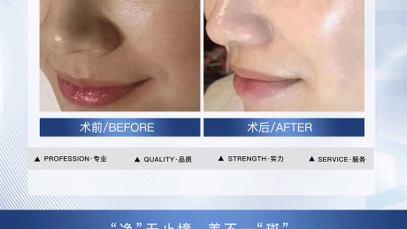 医美咨询师工作流程表格：揭秘专业咨询的规范化流程