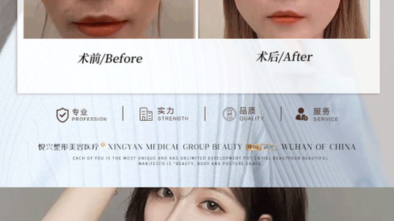社区皮肤管理中心与美容院区别
