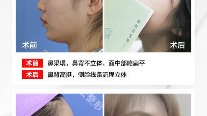 成都超声炮：揭秘其效果背后的技术奥秘