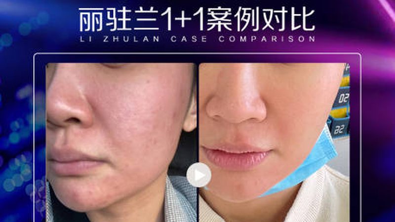 揭秘上海整形医院医生排名前十背后的真相