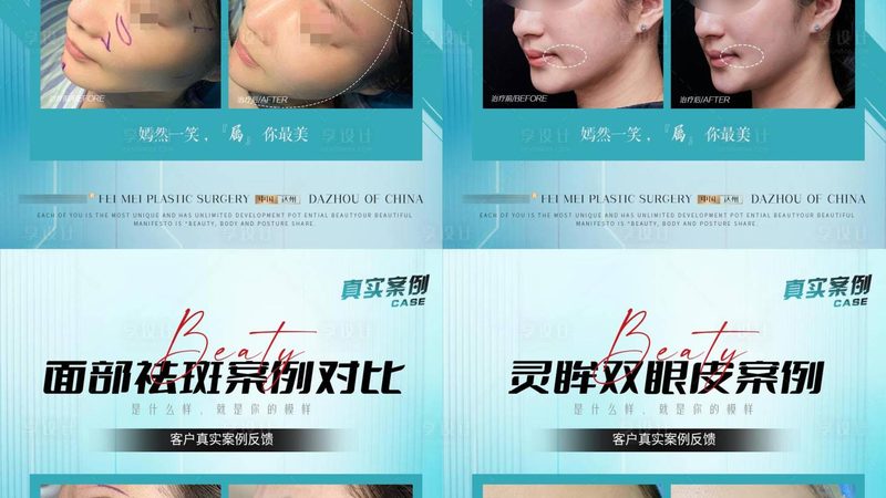 玻尿酸注射后注意事项人群