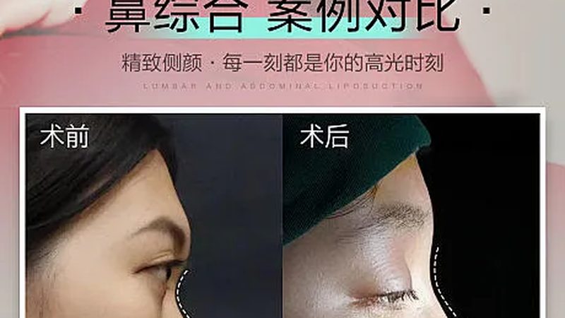 揭秘食品级玻尿酸：从原料到报价单的全方位解析