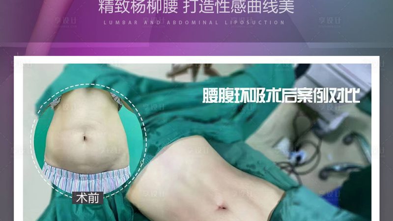 揭秘热玛吉价格差异之谜