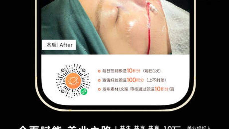 美容院专用玻尿酸原液，价格背后的秘密**