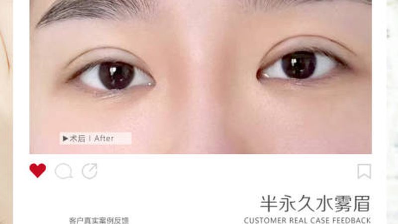 轻医美仪器厂家直销加盟，揭秘加盟政策背后的真相