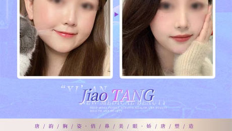 成都整形医院收费标准揭秘：如何理性选择