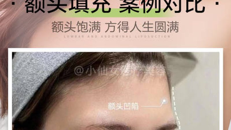 孕妇能用家用美容仪吗？揭秘安全使用指南**